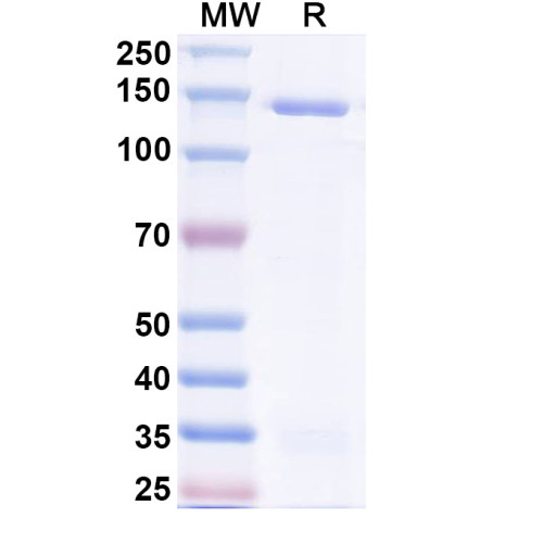 Human MDA5/IFIH1 Recombinant Protein (N-Strep) Human MDA5/IFIH1 Recombinant Protein (N-Strep)