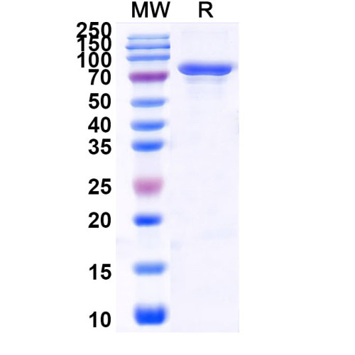 Human METTL3 Recombinant Protein (N-His)