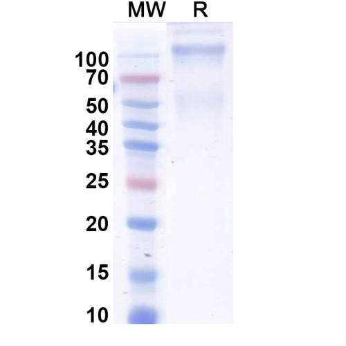 Human MET/c-Met/HGFR Recombinant Protein (C-His)