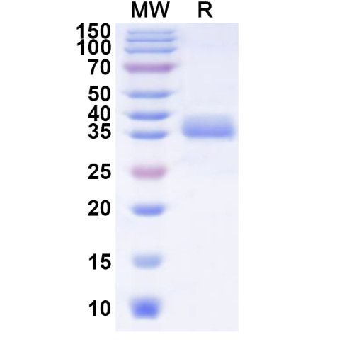 Human NEK2 Recombinant Protein (N-His) Human NEK2 Recombinant Protein (N-His)