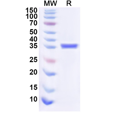 Human PDPN/Podoplanin Recombinant Protein (N-His-KSI)