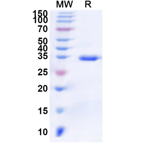 Human PRSS8 Recombinant Protein (N-His) Human PRSS8 Recombinant Protein (N-His)