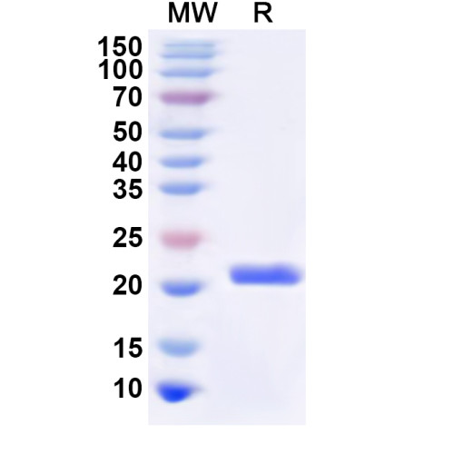 Human RPS2 Recombinant Protein (N-His)