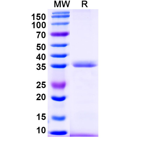 Human SERPINA7 Recombinant Protein (N-His) Human SERPINA7 Recombinant Protein (N-His)