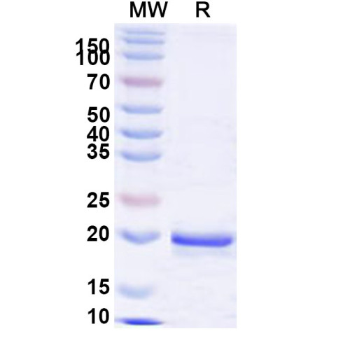 Human SFPQ Recombinant Protein (N-His) Human SFPQ Recombinant Protein (N-His)