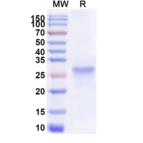 Human SH2B3 Recombinant Protein (N-His) Human SH2B3 Recombinant Protein (N-His)