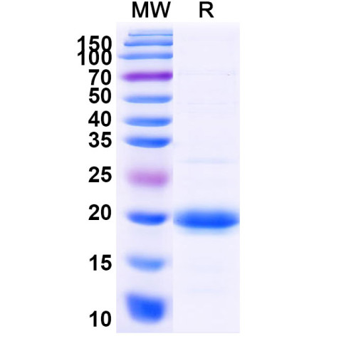 Human SLC10A1 Recombinant Protein (N-His-SUMO)