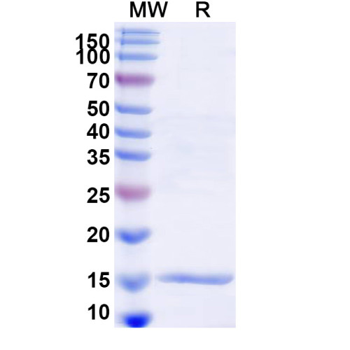 Human SLC30A8 Recombinant Protein (N-His)