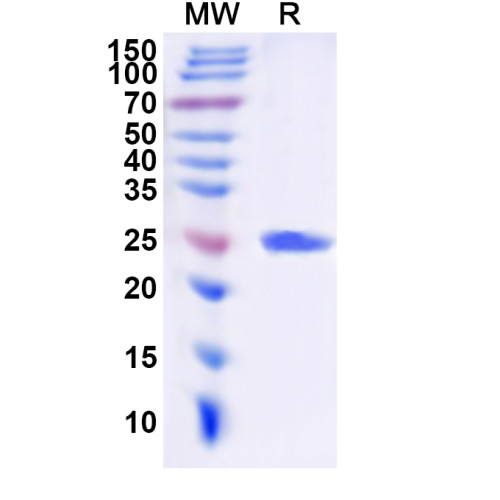 Human SLC6A1 Recombinant Protein (N-His-KSI) Human SLC6A1 Recombinant Protein (N-His-KSI)