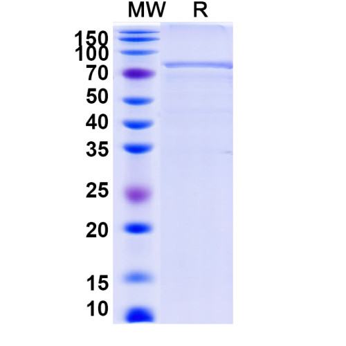 Human STAT1 Recombinant Protein (N-His) Human STAT1 Recombinant Protein (N-His)