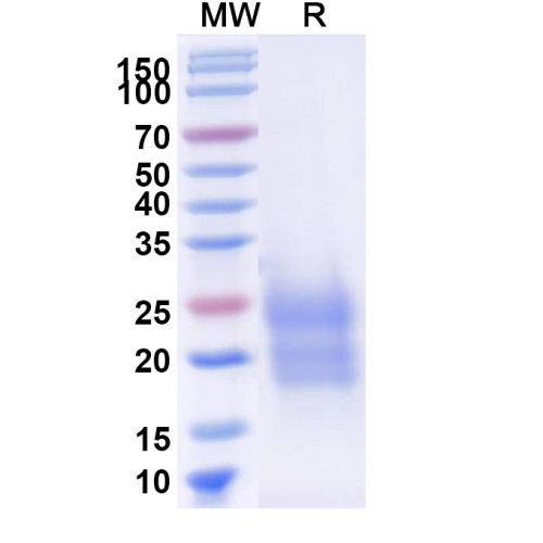 Human TDGF1/CRIPTO Recombinant Protein (C-His) Human TDGF1/CRIPTO Recombinant Protein (C-His)