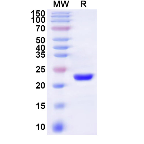 Human TRAM1 Recombinant Protein (N-His-KSI) Human TRAM1 Recombinant Protein (N-His-KSI)