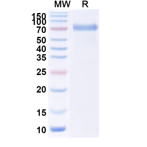 Human TSHR/LGR3 Recombinant Protein (C-Fc) Human TSHR/LGR3 Recombinant Protein (C-Fc)