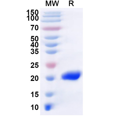 LSDV IMV envelope protein/LSDV060 Recombinant Protein (N-His) LSDV IMV envelope protein/LSDV060 Recombinant Protein (N-His)