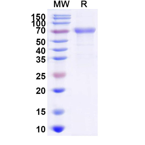 Mojiang virus/MojV G/Glycoprotein Recombinant Protein (C-Strep) Mojiang virus/MojV G/Glycoprotein Recombinant Protein (C-Strep)