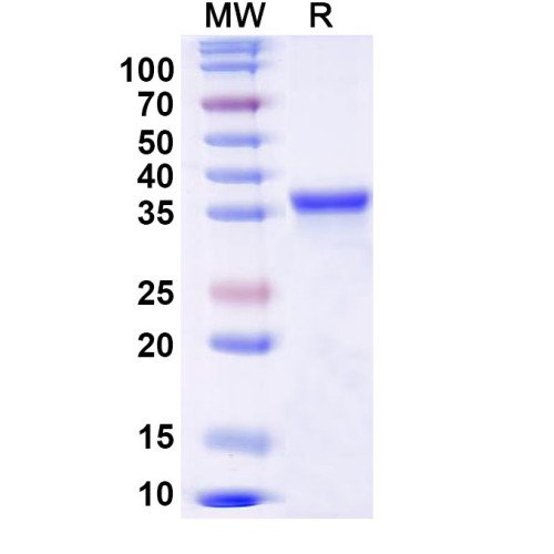 Mouse RIPK1 Recombinant Protein (N-His) Mouse RIPK1 Recombinant Protein (N-His)