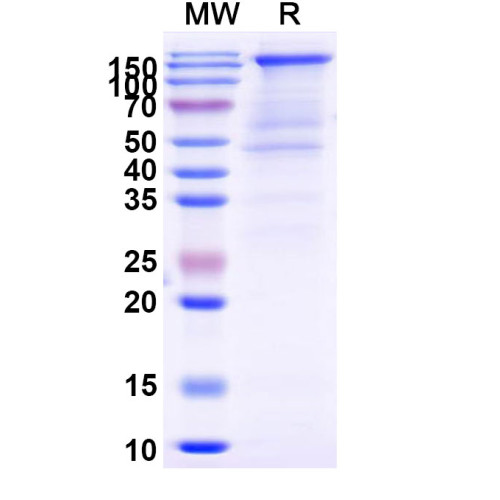 SARS-CoV-2 S Trimer (wt) Recombinant Protein (C-His) SARS-CoV-2 S Trimer (wt) Recombinant Protein (C-His)
