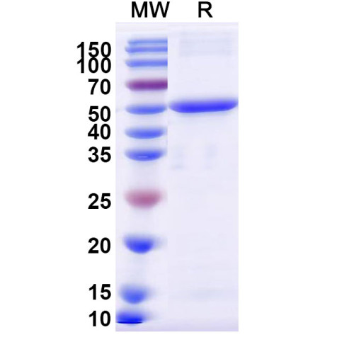 SINV Spike glycoprotein E1 Recombinant Protein (N-His)