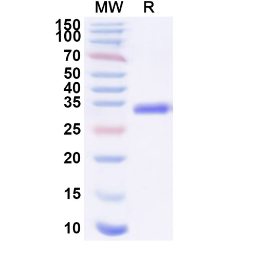 Staphylococcus phage entA/SEA Recombinant Protein (C-His) Staphylococcus phage entA/SEA Recombinant Protein (C-His)