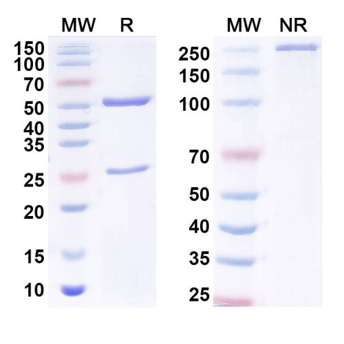 Anti-4R-HNE/4-HNE Antibody (R310)