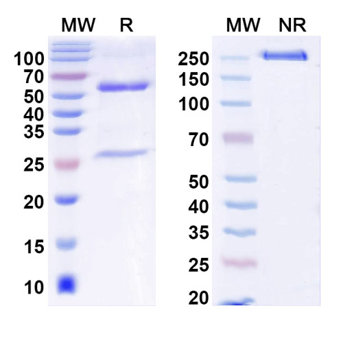 Anti-ANO5/TMEM16E Antibody (N421A/36)