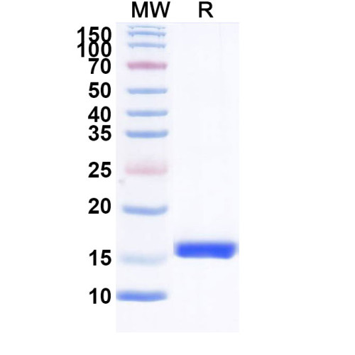 Anti-AZT/Aztreonam Nanobody (SAA1370) Anti-AZT/Aztreonam Nanobody (SAA1370)