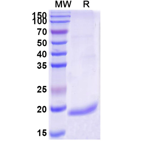 Anti-Bacillus anthracis PAD4 Nanobody (VHH10) Anti-Bacillus anthracis PAD4 Nanobody (VHH10)