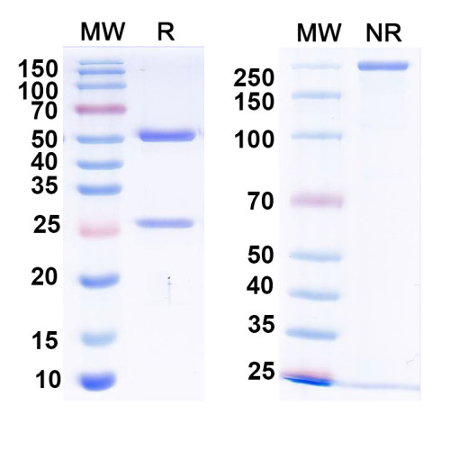 Anti-Beta-2 adrenergic receptor Antibody (N430/20) Anti-Beta-2 adrenergic receptor Antibody (N430/20)