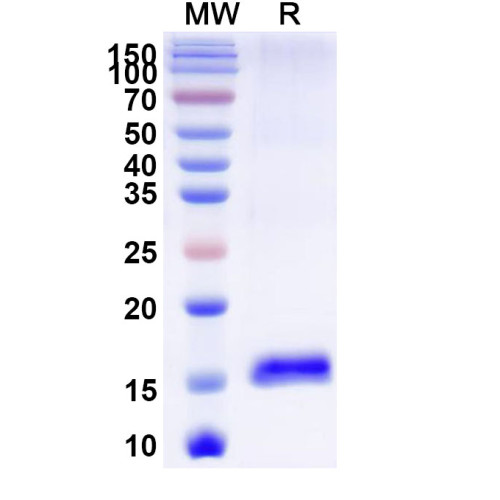 Anti-Castor bean Ricin Nanobody (SAA1001) Anti-Castor bean Ricin Nanobody (SAA1001)