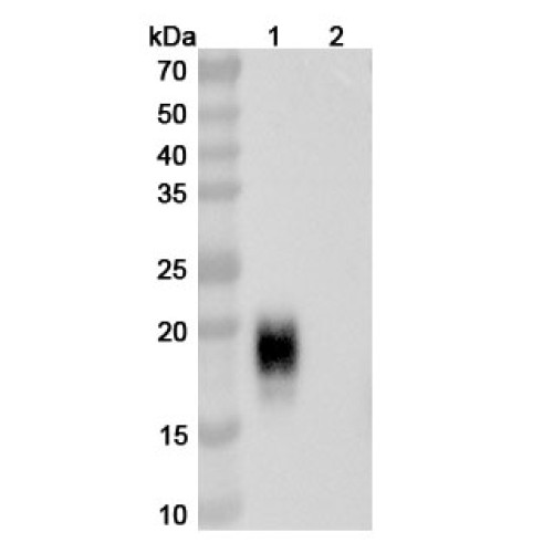 Anti-Cat CH1 & CH2/Allergen Fel d I-A & B Antibody (SAA2223) Anti-Cat CH1 & CH2/Allergen Fel d I-A & B Antibody (SAA2223)