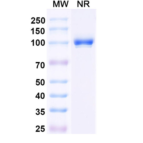 Anti-Clostridium botulinum botA/BOTOX Antibody (Aa1)