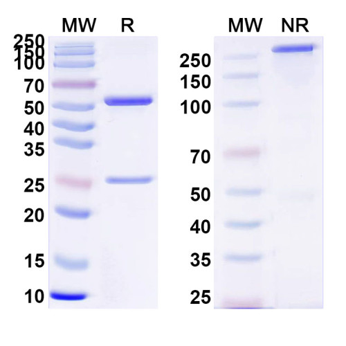 Anti-Clostridium tetani tetX/Tetanus toxin Antibody (SAA0862)