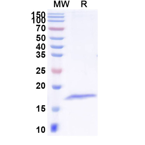 Anti-Clostridium tetani tetX/Tetanus toxin Nanobody (SAA1236)