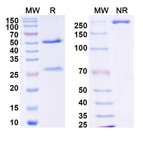 Anti-DENV-2 NSP5/NS5 Antibody (1D8) Anti-DENV-2 NSP5/NS5 Antibody (1D8)