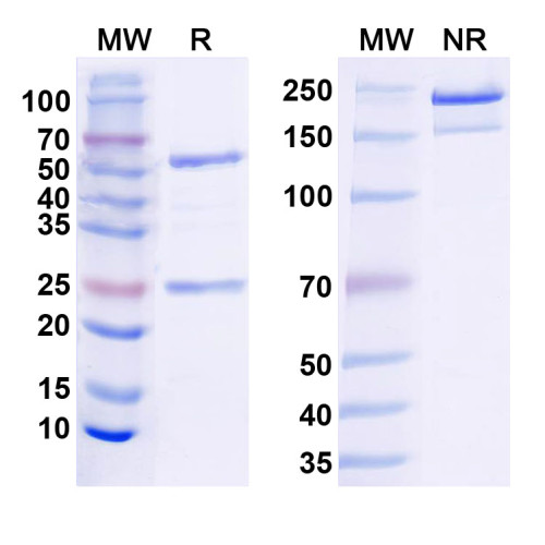 Anti-GABA(A)R, Theta Antibody (L123/67) Anti-GABA(A)R, Theta Antibody (L123/67)