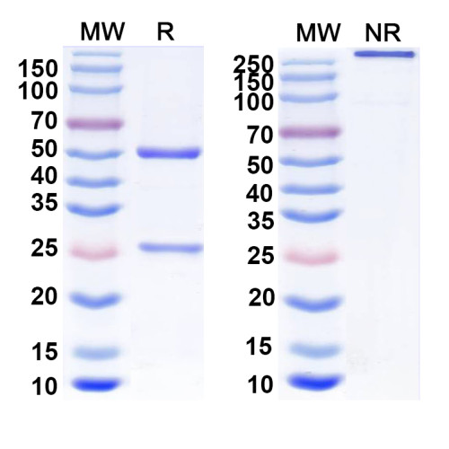 Anti-GalR2 Antibody (N407A/19)