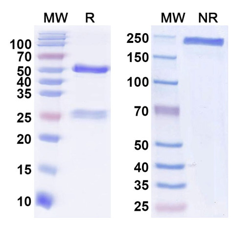Anti-GluN2B/NR2B glutamate receptor Antibody (N59/36) Anti-GluN2B/NR2B glutamate receptor Antibody (N59/36)