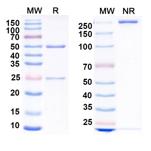 Anti-GluN2D/NR2D glutamate receptor Antibody (N437/81) Anti-GluN2D/NR2D glutamate receptor Antibody (N437/81)