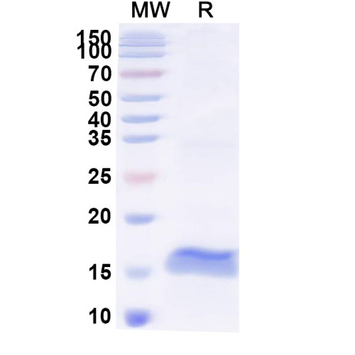 Anti-HIV-1 Vif/SOR protein Nanobody (SAA1421)