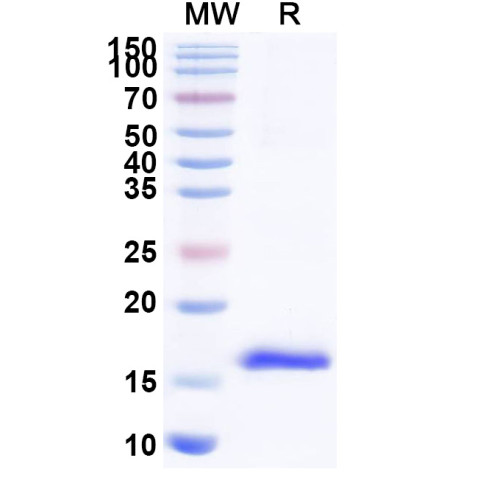 Anti-HIV-1 nef/F-protein protein Nanobody (SAA1423) Anti-HIV-1 nef/F-protein protein Nanobody (SAA1423)