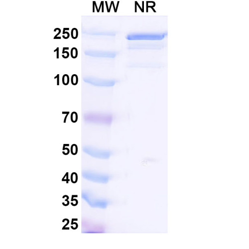 Anti-HLA-A2-peptide (SLLMWITQV) Complex (3M4E5)