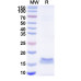 Anti-HMPV Fusion glycoprotein F0 Nanobody (SAA2194)