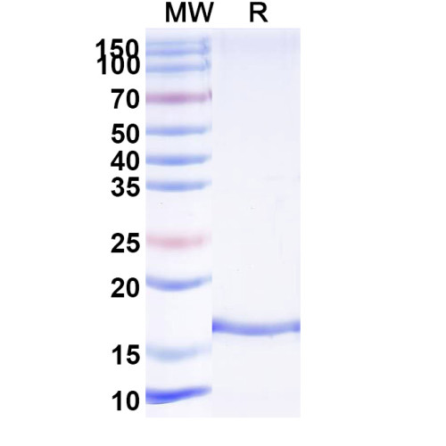 Anti-Human ADAMTS13-cleaved VWF Nanobody (KB-VWF-F1.1) Anti-Human ADAMTS13-cleaved VWF Nanobody (KB-VWF-F1.1)