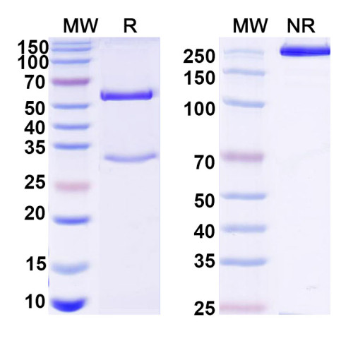 Anti-Human ADAMTS4 Antibody (7C7) Anti-Human ADAMTS4 Antibody (7C7)