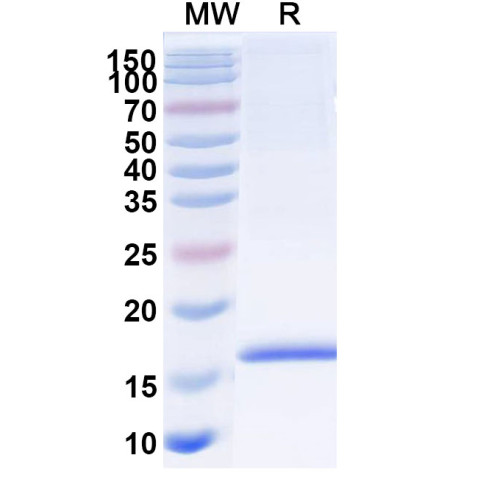 Anti-Human Adiponectin/ACRP30/ADIPOQ Nanobody (SAA1153) Anti-Human Adiponectin/ACRP30/ADIPOQ Nanobody (SAA1153)