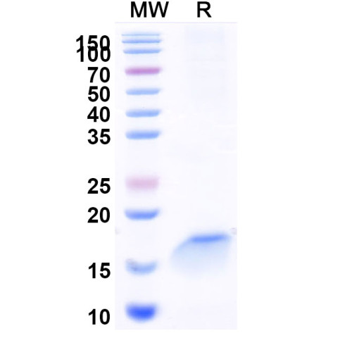 Anti-Human CD197/CCR7 Nanobody (SAA1349)