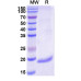 Anti-Human CD202b/TEK/TIE-2 Nanobody (SAA1254) Anti-Human CD202b/TEK/TIE-2 Nanobody (SAA1254)