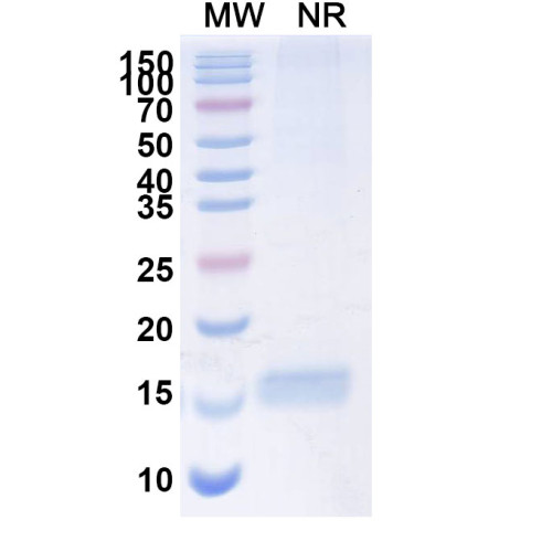 Anti-Human CD309/KDR/VEGFR-2 Nanobody (SAA1230) Anti-Human CD309/KDR/VEGFR-2 Nanobody (SAA1230)