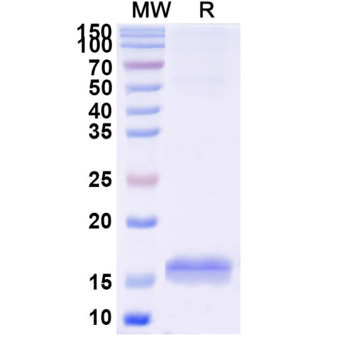 Anti-Human CD33 Nanobody (SAA2052) Anti-Human CD33 Nanobody (SAA2052)