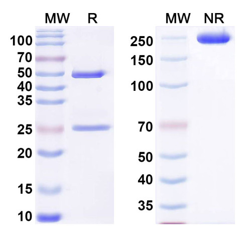 Anti-Human COL2A1 Antibody (UL1) Anti-Human COL2A1 Antibody (UL1)